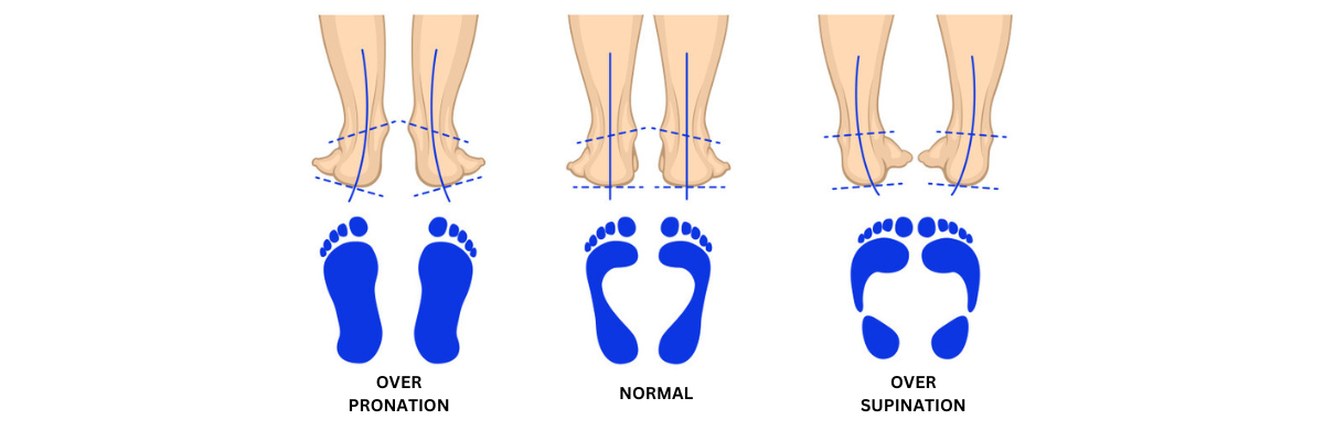 Gait Analysis Natterjack Running